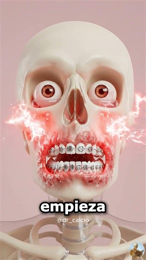 QUÉ hacen REALMENTE los BRACKETS