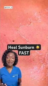 How to Heal Sunburn Fast ☀️ Do’s & Don’ts | Doctor Explains