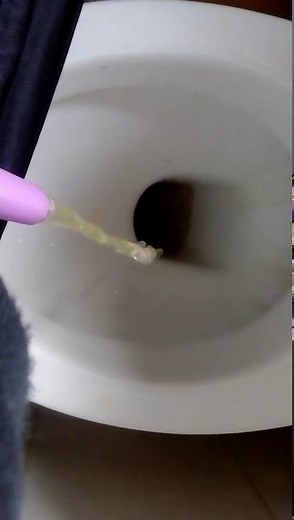 Urination device (for women)