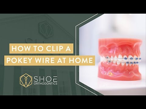 Here’s How to Cut Braces Wire At Home - Shoe Orthodontics