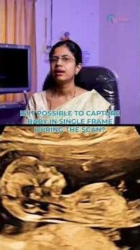 Can you see your baby's face in tbe scan? 👶#wmndoctors #pregnancyscans
