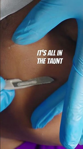 Pro Esthetician Demo: Up Close Dermaplaning Technique for Smooth Skin