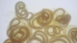 The nematodes , roundworms or eelworms constitute the phylum...