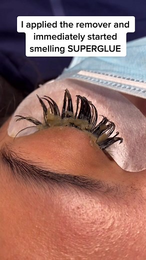 Eyelash Extensions Gone Wrong: A Cautionary Tale