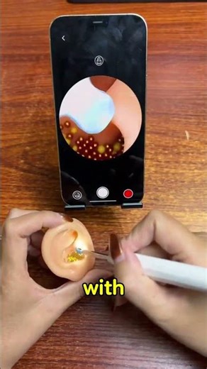 Wireless Ear Wax Removal Camera WiFi Ear Endoscope with LED Light Review