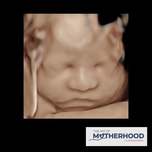 ✨ Check out our latest RealView Enhanced Image! ✨ Bring your ultrasound session to life with stunning detail and depth. Add a RealView or HyperRealistic enhanced image to your package when booking — and remember, it’s included in Package 6! 💕 📲 Book your session today: www.ArtofMotherhood.com #RealView #hyperrealistic #sneekpeek #4DUltrasound #HDUltrasound #3dultrasound #savannahga #richmondhillga #babyultrasound #ultrasound #richmondhillmoms #hinesvillega #poolerga #momtobe #8k | Whitney at T