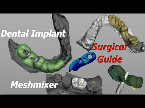 Surgical Guide using - Meshmixer