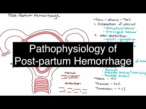 Pathophysiology of Postpartum Hemorrhage