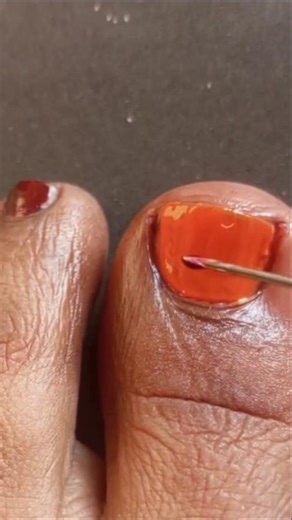 Easy Toe Nail Art Design For Beginners 🍓 Simple and Classy Nails 💅 #shorts #nails