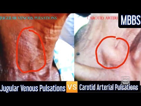 Jugular Venous Pulsations 🆚 Carotid Arterial Pulsations #medicine #mbbs #cvs #usmle #neetpg