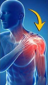 🔥 Shoulder Pain? 😱 Here’s Why Rotator Cuff Strengthening Is the REAL Fix! 💪 #Shorts