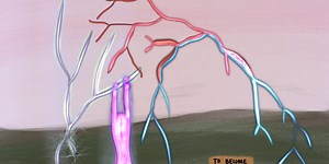 How I Overcame Perfectionism