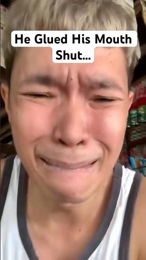 😱 He Glued His Mouth Shut With Super Glue?!
