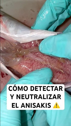 ANISAKIS: CÓMO DETECTARLO Y NEUTRALIZARLO 🪱