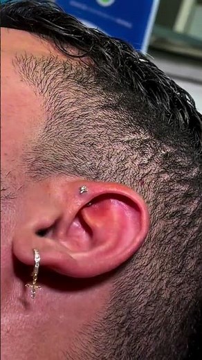 Forward Helix Piercing Aftercare | How to Clean a Cartilage Piercing