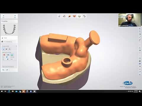 Digital Dentistry Training Series: Custom Impression Tray
