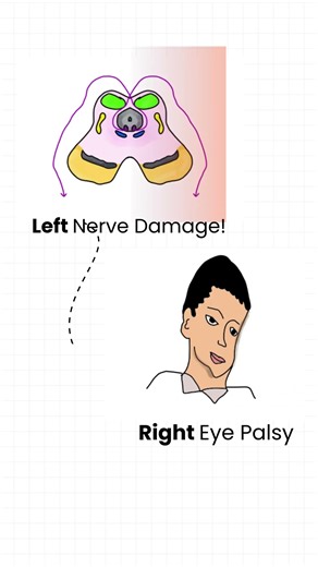 This Cranial Nerve Breaks Every Rule