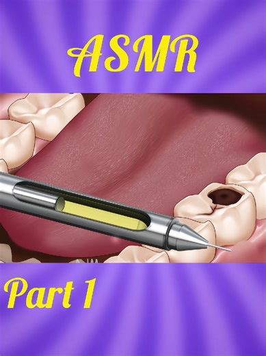 ASMR Teeth Treatment 1st part #ASMR #ASMRtreatment #asmrsatisfying #asmrrelixing #viralasmr #ConSantanderConecto