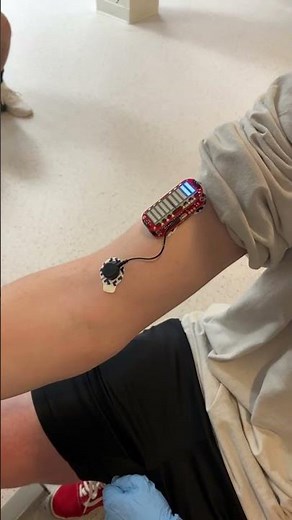 Rise of Legends: Testing SparkFuns MyoWare Muscle Sensor Kit | How To Measure Muscle Activity