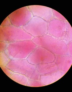 Cellphone Microscope: Turn a Phone Into a Functional Piece of Scientific Medical Equipment (Science-hack Your Phone: Part 1) | Science Buddies Blog