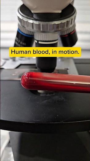 Red blood cells under the microscope?