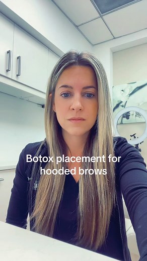 Botox placement for hooded brows shown above! We tend to stay away from botox placement in the forehead or frontalis muscle if your main priorty is lifting and hooded eyelids 💉👀 #hoodedeyes #botox