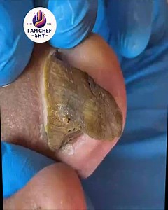 Gentle Nail Tips for Elderly Toenails Recommended by Experts #WellnessNails #GentleToenailCare #SeniorNailCare #NailSupportSeniors | I am Chef Shy