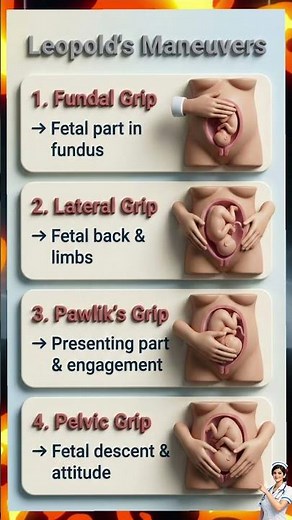 Learn Leopold's Maneuvers: Fundal to Pelvic Grip#LeopoldsManeuvers #Obstetrics #OBG#biology