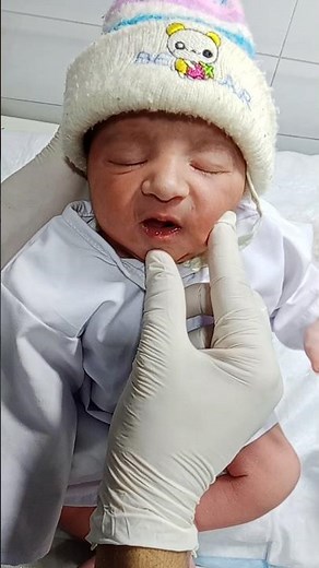 Newborn Baby – Checking Reflex Moments After Delivery | Healthy Newborn Care