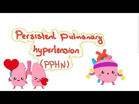 Persistent pulmonary hypertension (PPHN) in neonates