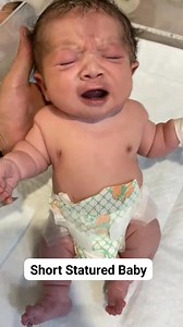 Short stature in newborns can be caused by malnutrition (stunting), premature birth, or genetic conditions such as achondroplasia (dwarfism), which causes impaired bone growth, resulting in disproportionately short limbs and a larger head. #babylove #babycare #nicubaby #newbornbaby #babybirth | Yuli Ismalia