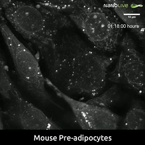 Nanolive live cell imaging microscope: Apoptosis in Preadipocyte living cell