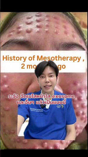 ระวังเจอบ่อย ฉีดเมโสหน้าใส exosomes เมโสรักษาฝ้า กระชับรูขุมขน แล้วกลายเป็นแบบนี้