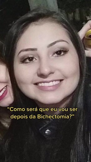 Bichectomia: Transformação do Rosto Antes e Depois