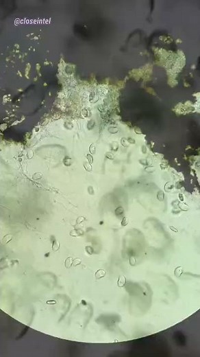 Chlorine vs Germs Under Microscope