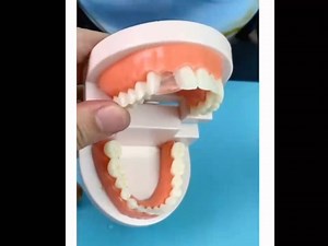 Watch Tooth Repair Granules on Amazon Live