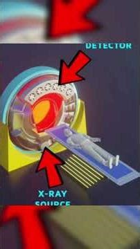 La magie du scanner expliquée en 60 secondes #physics #médecine