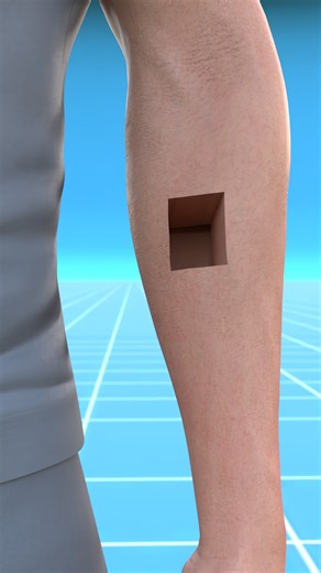 😱 What Happens If We Slice Through Human Skin? (Explained in 3d Animation)