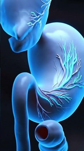 Gastric Dilatation–Volvulus GDV