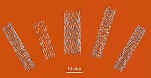 World’s first 3D printed nitinol stent
