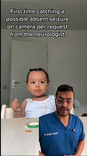 يبدو الأمر غير ضار… ولكنه نوبة صرع