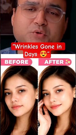 Look 10 Years Younger Naturally 😳 Anti-Aging Home Remedies | Youthful & Glowing Skin #beauty #viral