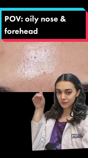 Hormonal Effects on Oily Skin | Causes and Solutions