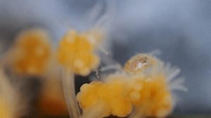 Acariens sous microscope, famille des Halacaridae, : vidéo de stock (100 % libre de droit) 3980246989 | Shutterstock