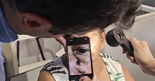 Expanding Access to Early Skin Cancer Detection