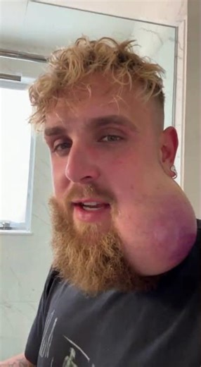 My chin is now a pillow 😳 #jakepaul #boxing