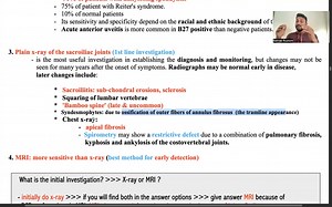 Seronegative arthritis, SLE, systemic slerosis এর এই ক্লাসটা আপনার জীবনের সেরা ক্লাস হবে। একটু সময় নিয়ে ক্লাসটা দেখবেন। #Sohrab_Medicine বইয়ের ক্লাস 😊, #শেয়ার করে রেখে দিন। | Dr-Sohrab Rustom