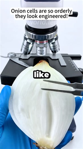 Onion under the microscope.