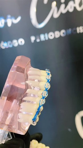 Understanding Orthodontic Braces in Dental Practice