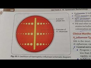 SATELLITISM IN HAEMOPHILUS INFLUENZAE